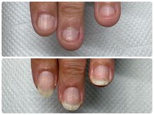 ブルームーンネイルズ(BLOOMOON.nails)/初回→３回目