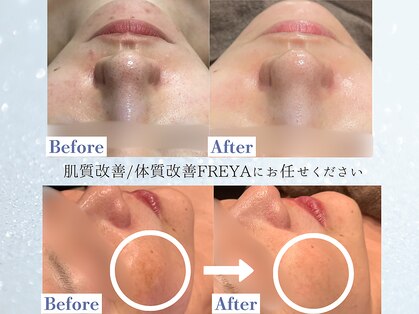 フレイヤ(FREYA)の写真