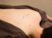 ハリコ 代官山/鍼の効果を体験してみてください