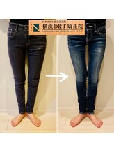 横浜DRT矯正院/O脚矯正