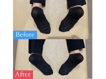 ナオル整体 宮崎院(NAORU整体)/20代女性施術事例【左右脚長差】