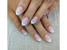 ツインヒール(TwinHeal)/フレンチ