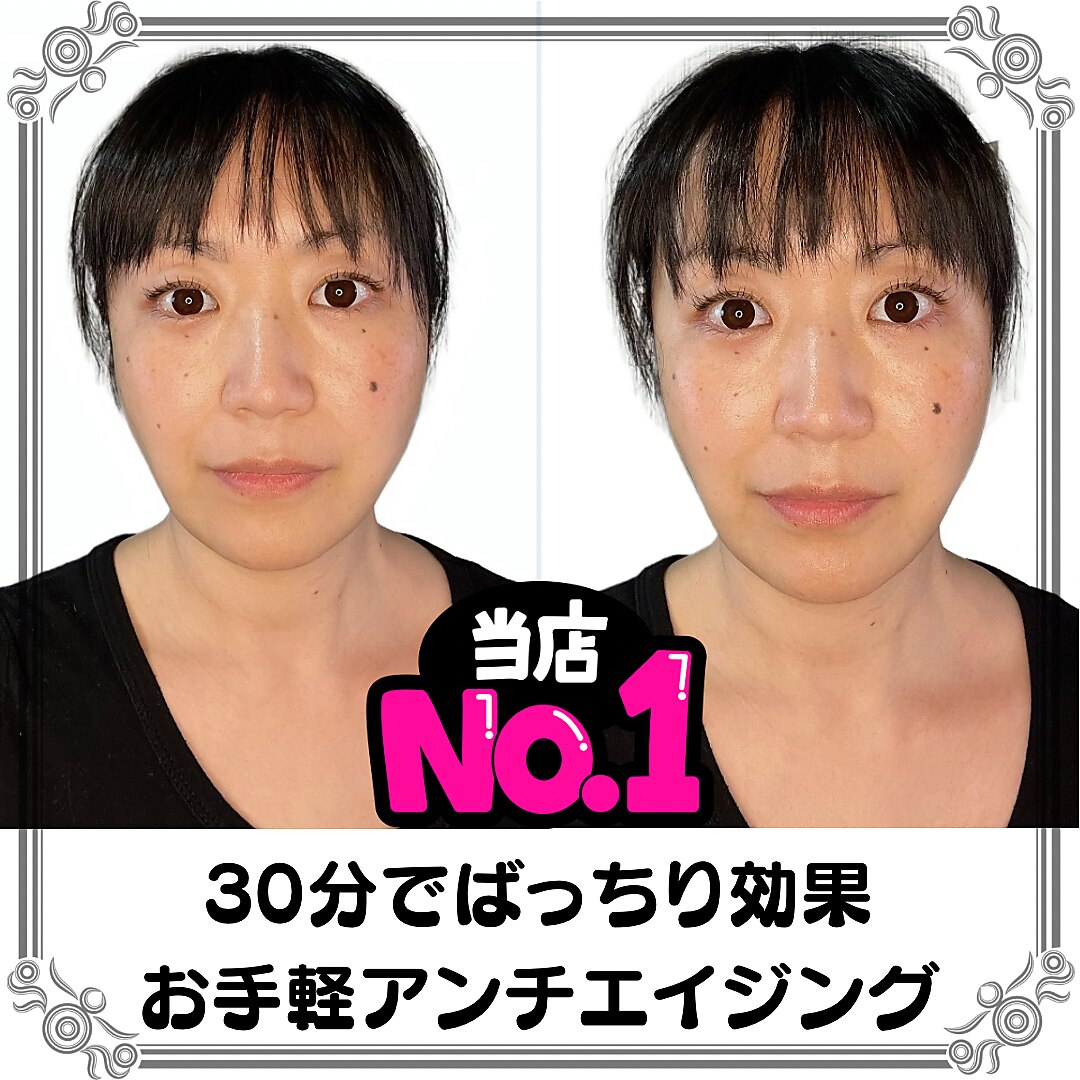 一気にたるみが進んだとお悩みの方に◎リピーター様多数の小顔エステが5250円