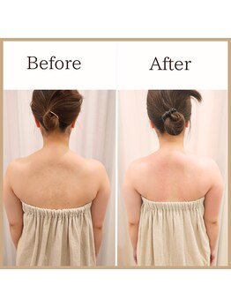 サロンルーチェ(Salon Luce)/ビフォーアフター/施術回数9回