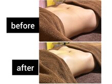 シャルールプラス(chaleurplus)/腸もみ後