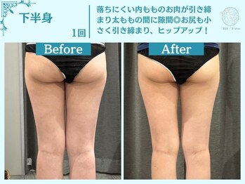 フローフシ∞/【痩身】下半身・お尻の脂肪撃退