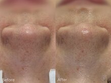 ミュー 栄本店(mieux)/お客様Before/After