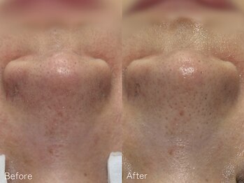 ミュー 栄本店(mieux)/お客様Before/After