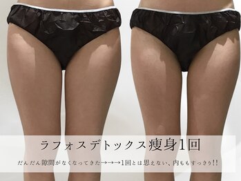 ミヨンラボ(miyon LABO)/ラフォスデトックス痩身1回