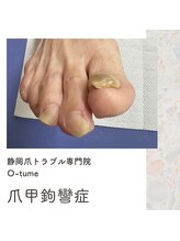 オツメ 静岡(O-tume)/爪甲に厚み