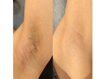 エースビューティー(Ace.Beauty)の雰囲気（まずは無料カウンセリングでお悩みを聞かせて下さい♪体験実施中）