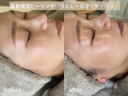 アンバインド(Unbind)の写真