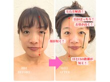 ニコリ 横浜(NICOLI)の雰囲気（頭蓋骨から矯正することでたくさんのお顔のお悩みが解決！）