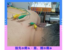 フラット柏(FLAT柏)/首・指先への症状【鍼灸・整体】