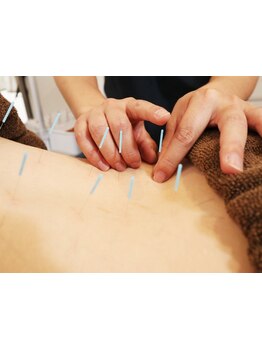 腰のつらさを改善したい