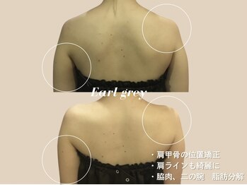 エステティックサロン アールグレー/ブライダルエステ2