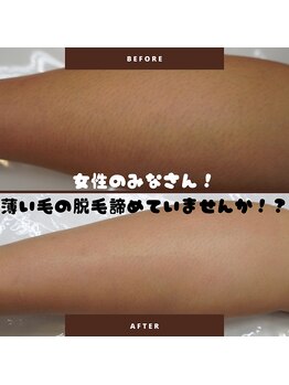 メロウ(mellow)/レディース脚6回施術☆