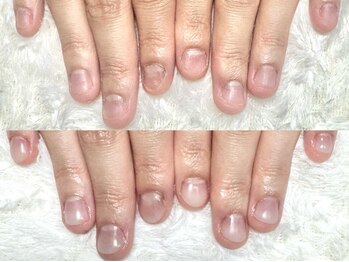 グレースレディ 大阪店/(深爪/長さだし/フィルイン)