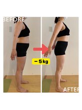 ルーク セイタイ(LUKE)/２ヶ月ビフォーアフター