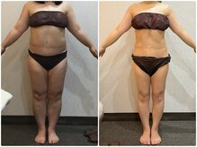 美容整体ウェリナ あま甚目寺院/小顔矯正/骨盤矯正/美脚サロン