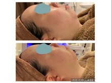 ローズマリー(rosemary)/