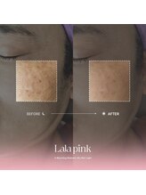 グラッソ(GRASSO)/ララピンク