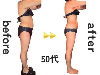 ジュリアン(Julien)/【お客様結果写真】[麹町/痩身]