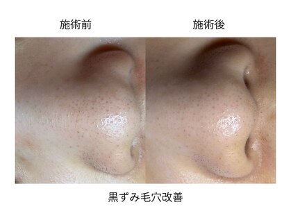 ソワンドボーテ クー(Soin de Beaut'e Quu)の写真