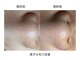 ソワンドボーテ クー(Soin de Beaut'e Quu)の写真