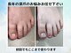 ブルームーンネイルズ(BLOOMOON.nails)の写真/【フットの深爪のお悩みに】その日のうちに見た目の変化を実感◎サンダルも楽しめる足元へ