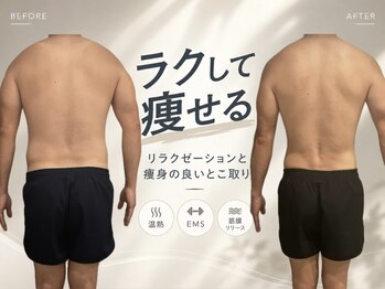 エステティック ミュー(Esthetic MiEUX)の写真/【脱・だらしない体】腹・腰・背中をまとめてスッキリ痩身。マシンとオイルマッサージで日々の疲れも一掃！