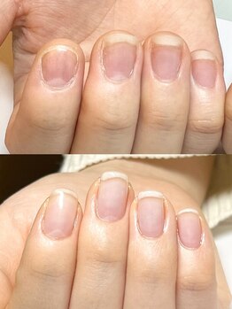 マリーロール 梅田店(Marie Laure)/自爪育成/深爪矯正/ネイルケア