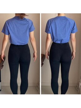 ザ エスアップ 博多店(THE S-UP)/施術前後写真