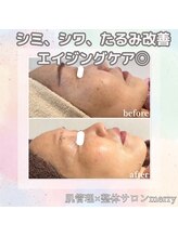 メリー 大和八木店(merry)/お肌が潤いハリ艶美肌へ★