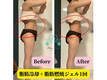 パラアモール(Paraamor)の雰囲気（筋トレしても痩せない「固太り」卒業！脂肪冷却&筋膜リリース★）