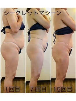 エステティックジュネス(JEUNESSE)/シークレットボディ