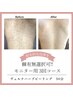 【本気の肌質改善モニター】ヴェルナハーブ3回◆艶肌◆毛穴レス◆ニキビケア