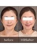 痩身・体型・不調｜骨格調整×深層筋膜リリース×リンパ×小顔コルギ ◆130分