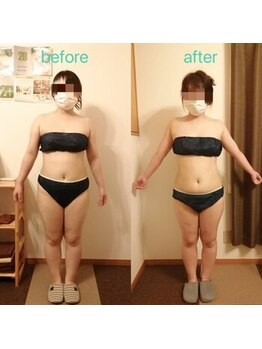 アンジュ/ハイパーナイフ全身贅沢コース