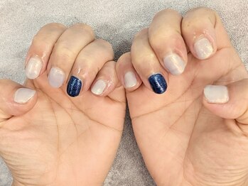 リ イノ ネイル ダツモウ(Re:ino)/ホワイトフラッシュ♪