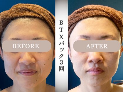 モルティー 宇都宮店(Molti)の写真