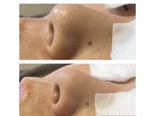 カンナム小顔 海老名店/