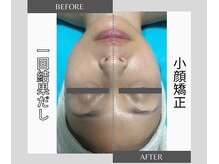 ウルオイ 海老名(URUoi)の雰囲気（オールハンドの結果だし小顔矯正何度でも4500円）