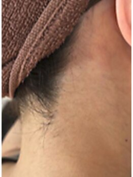 1回ごとにお支払い可能なサロン