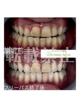 ホワイトニングサロン 札幌店/【ホワイトニング】#札幌#大通り