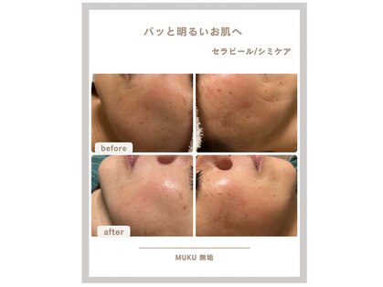 ムク(MUKU 無垢)の写真