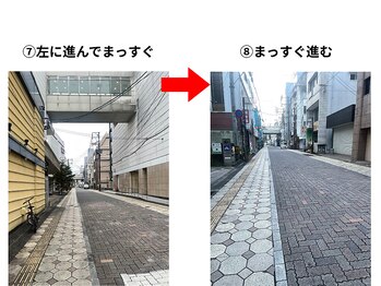 アノン 宮崎(anon)/【道順】共通してここを通ります