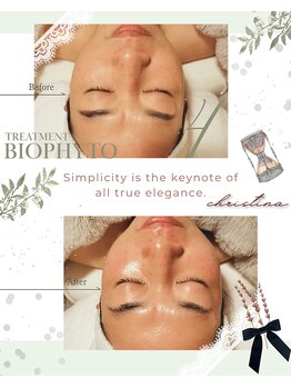 ハレル(Hareru)/Before…After(10)　BIOPHYTO