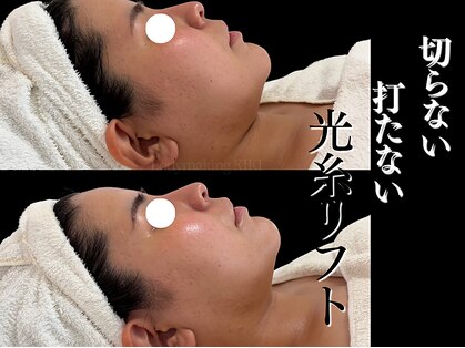 ボディメイキング キキ(Bodymaking KIKI)の写真