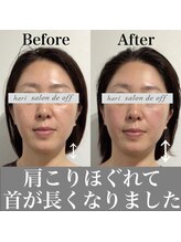 ハリサロンドオフ 心斎橋店(hari salon de off)/お顔とお身体同時にアプローチ